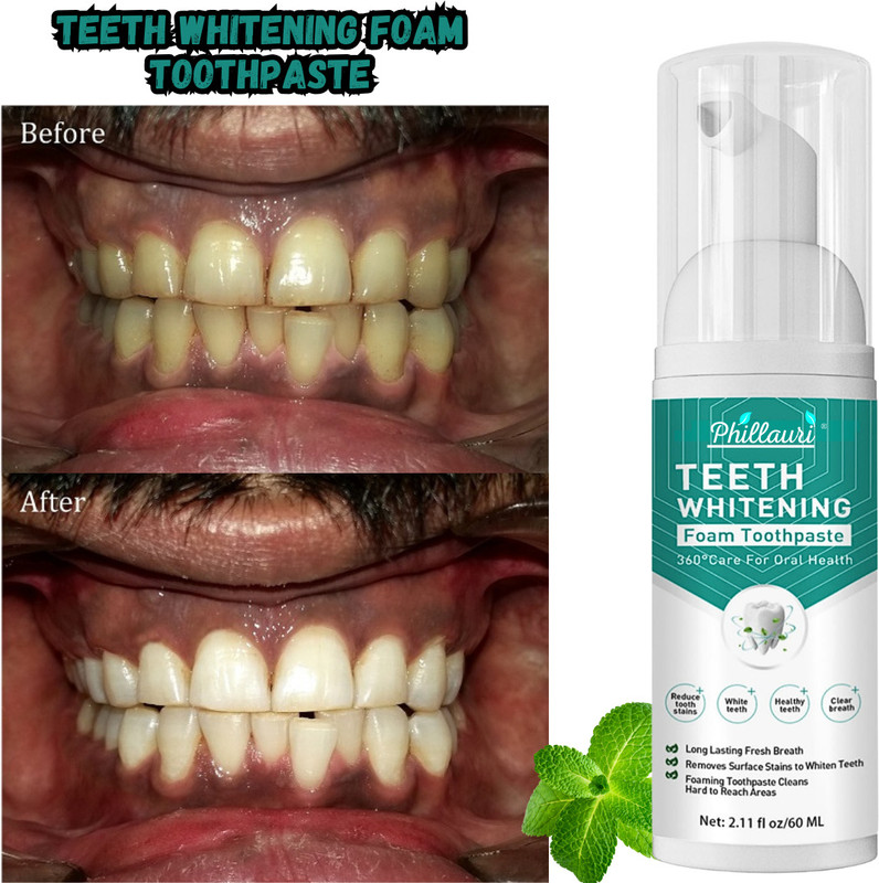 Phillauri Teeth Whitening Mousse Foam Toothpaste Stain Removal Freshen Breath Teeth Whitening Kit