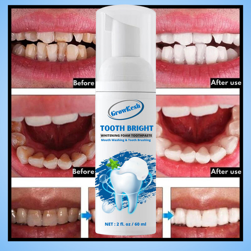 Growkesh Teeth Whitening Foam for a brighter, confident, and radiant smile Teeth Whitening liquid(60 ml)