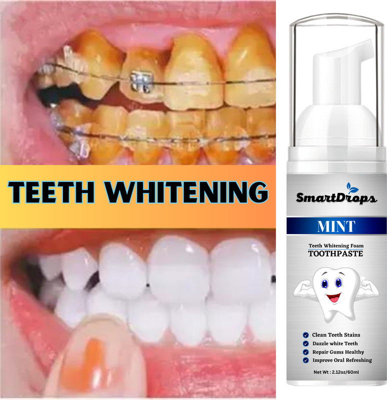 smartdrops Teeth Whitening Mousse Cleaning Mousse Hygiene Stains Spots Remover Teeth Whitening liquid(60 ml)