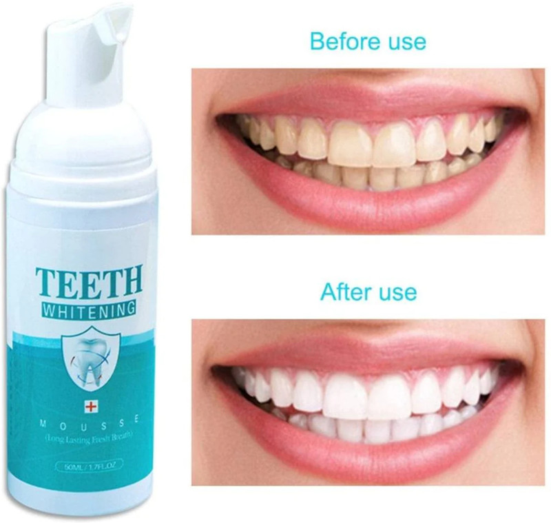 Latibule Foam Removes Bad Breath Fights Germs For Women & Men Teeth Whitening liquid(60 ml)