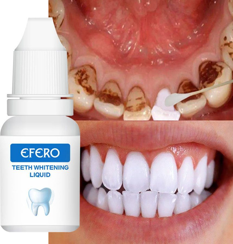 Toothon Smile Care Teeth Whitening Essence 10ml | Removes Stains | Bright Smile Teeth Whitening liquid(10 ml)