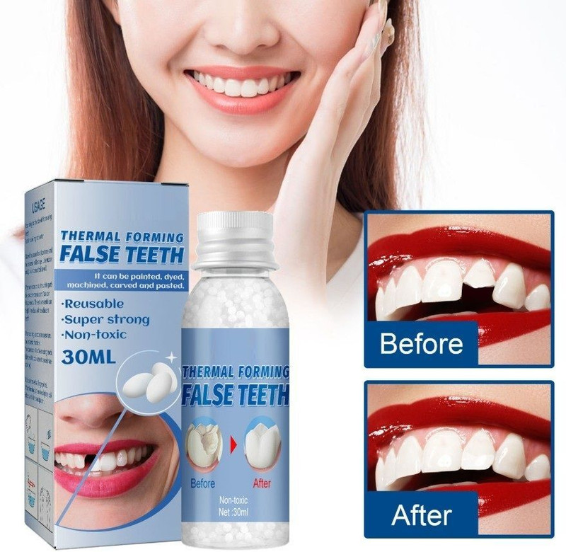 CHYLVY GO Advanced Temporary Teeth Replacement Kit Tooth Repair Kit Smile Restorer Teeth Whitening liquid(30 ml)