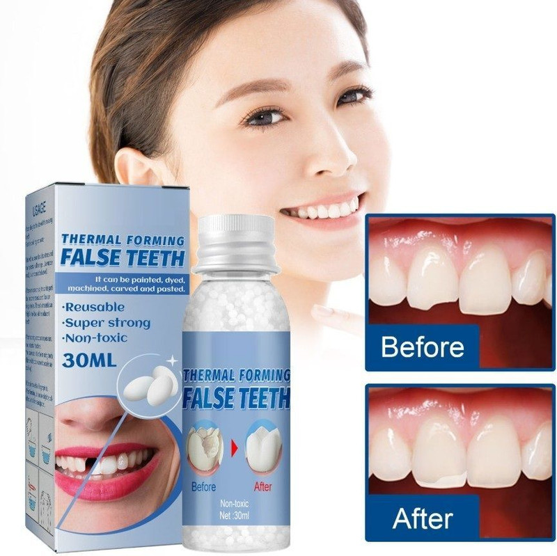EliGlowWhitewin Gentle Tooth Repair & Replacement Kit | Temporary Smile Fix | Easy to Use Teeth Whitening liquid(30 ml)