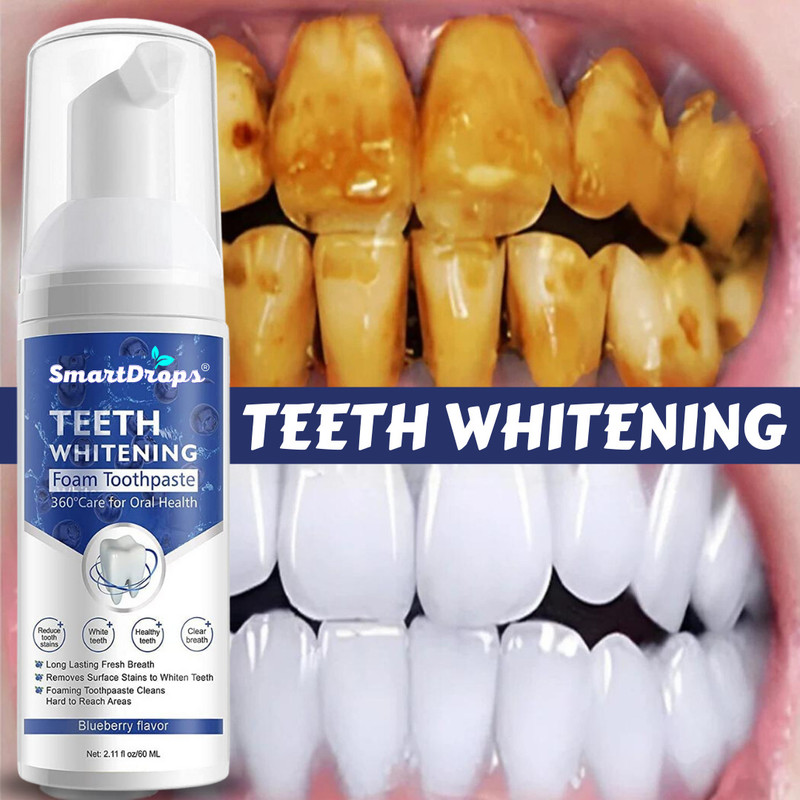 smartdrops Teeth Whitening Liquid For Your Smile's Radiance With Our Premier Teeth Whitening liquid(60 ml)