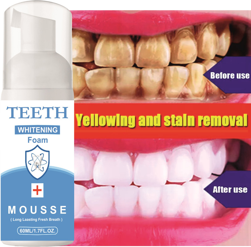Sthetik For Clean Teeth and Mouthwash oral care dental hygiene Teeth Whitening liquid(60 ml)