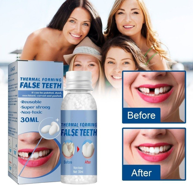Fyoxye Tooth Repair Kit for Home Use with Moldable Teether Beads Teeth Whitening Kit