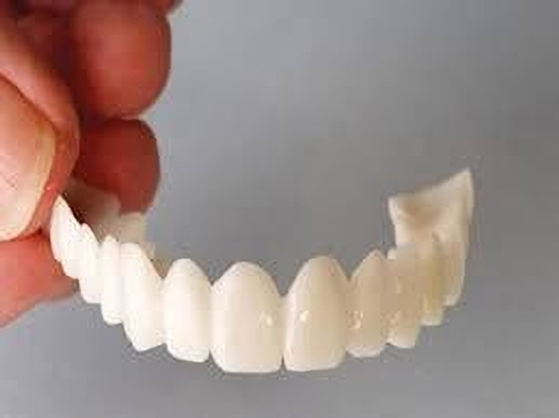 hanumant Temporary Smile Denture Teeth Top Fake Tooth Cover Teeth Wipe(Pack of1)