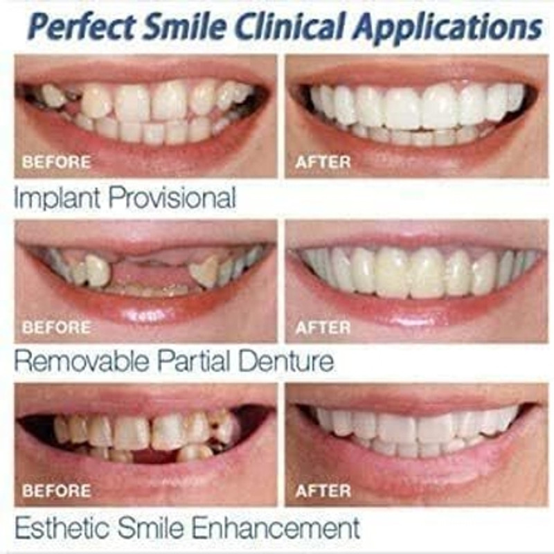 VRBUDDIES SNAP ON FAKE TEETH Teeth Wipe(Pack of1)