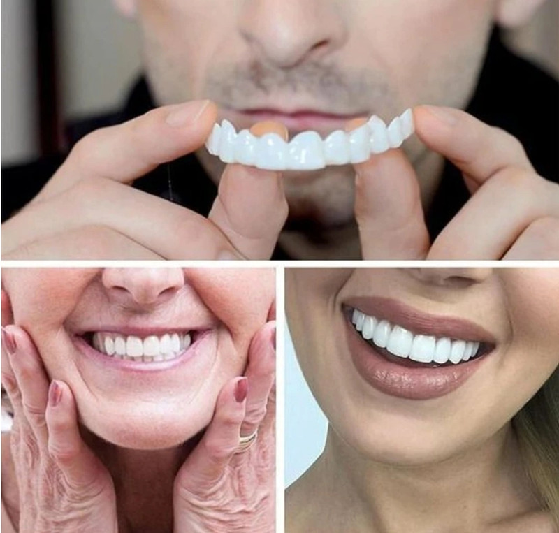 Kyara Snap On Smile Teeth Temporary Veneer Kit Reusable Dental Cover White Teeth Wipe Teeth Wipe(Pack of1)