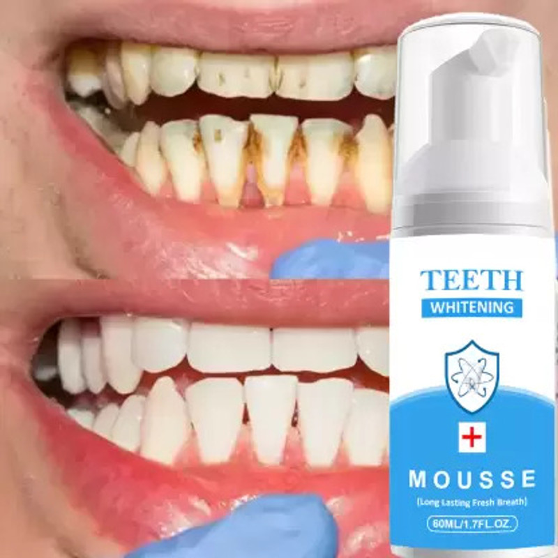 Sthetik Teeth Whitening Foam Gentle & Effective Formula Teeth Whitening liquid(60 ml)