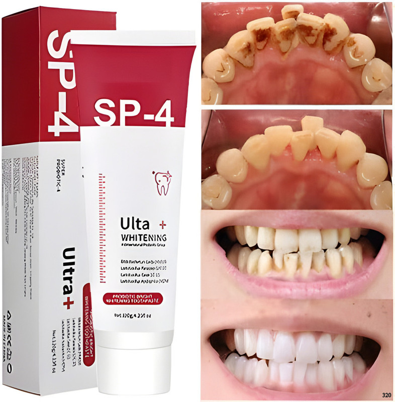 ERVY SP-4 Ultra Whitening Probiotic Toothpaste SP-4 Ultra Whitening Toothpaste Fast T Toothpaste(30 g)