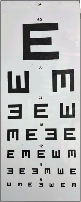 Eagle Eye Products EEP® || Professional Snellen Eye Test Chart || E Type Visual Acuity || 60-6 Line Trail Frame