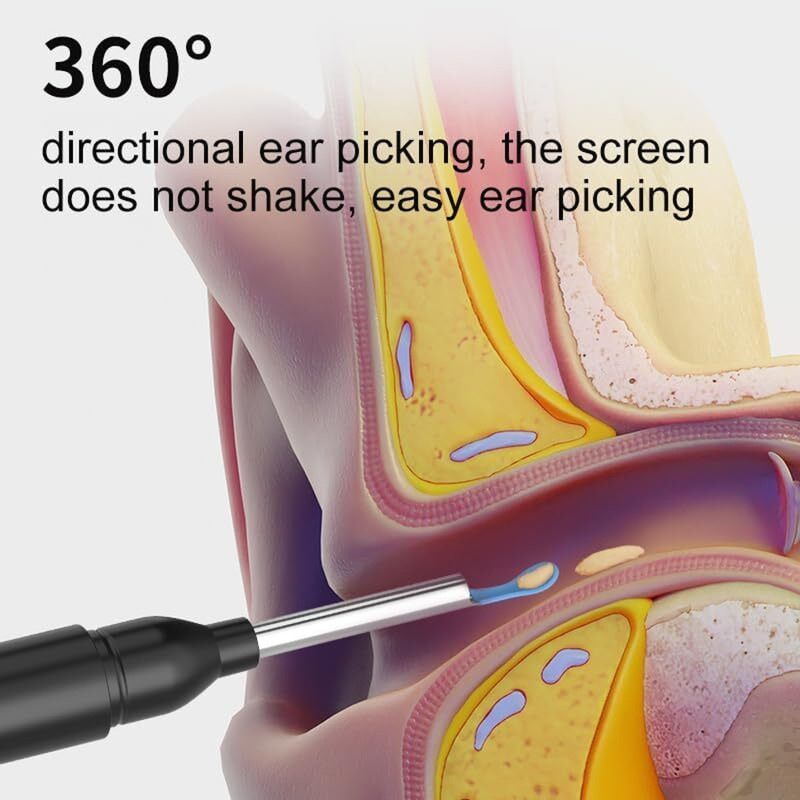 VISHIXIT 1PCS Ear Wax Removal Kit 1080P Ear Camera Otoscope with Light Ear Cleaning Kit