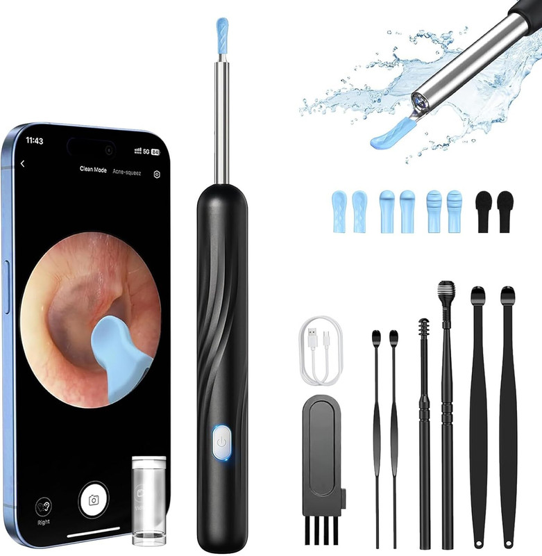 CARTSPACE Wireless Visual Ear Cleaner/Otoscope with Camera.