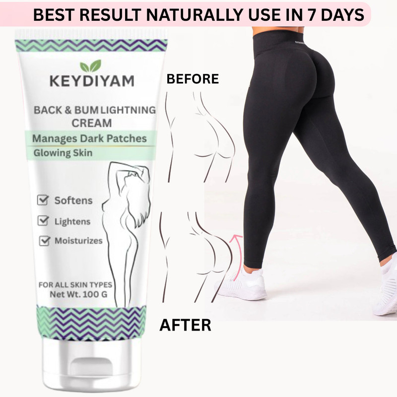 keydiyam BACK & BUMS LIGHNING CREAM WOMEN Intimate Cream(100 ml)