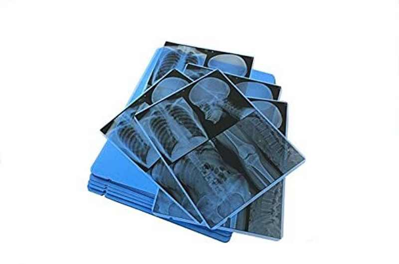 Anilmall 98 X-Ray Viewer(For Printing Use X-RAY, CR & DR)