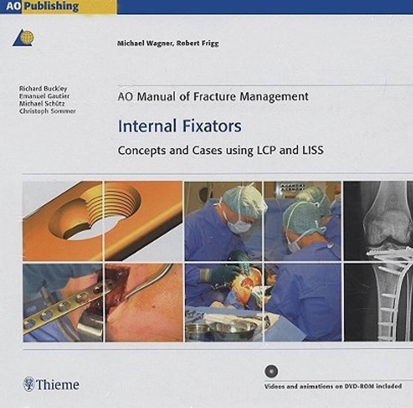 AO Manual of Fracture Management: Internal Fixators: Buy AO Manual of ...