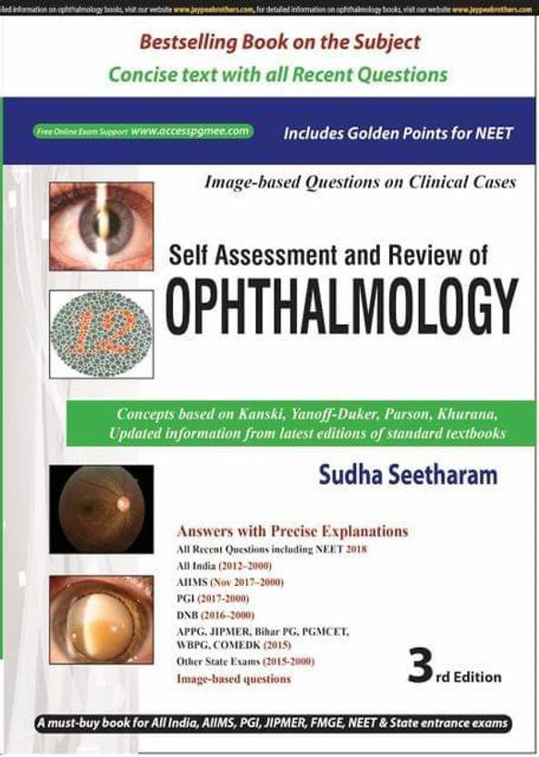 Ophthalmology books pdf free download Ophthalmology books pdf free download