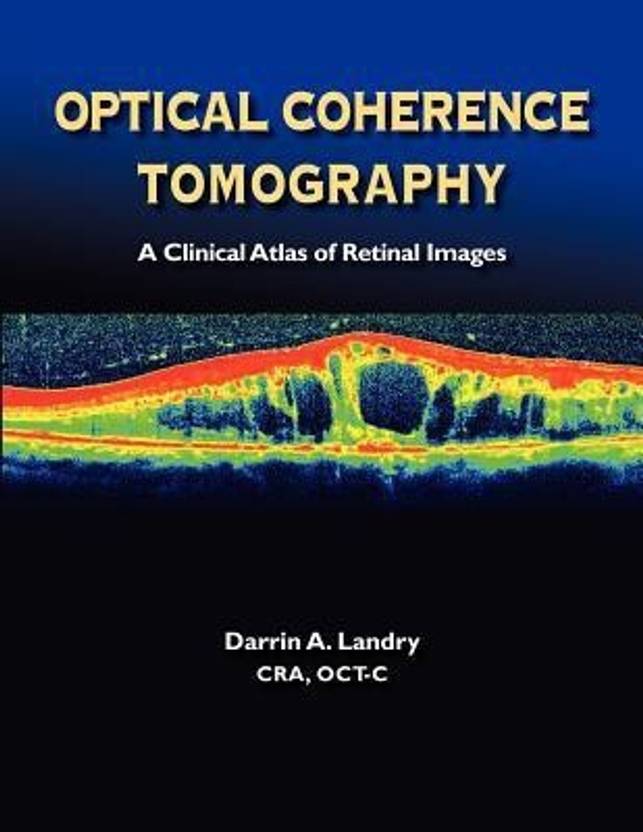 Optical Coherence Tomography a Clinical Atlas of Retinal Images By