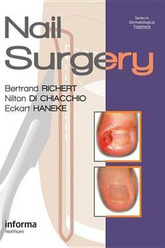 Nail Surgery Buy Nail Surgery by unknown at Low Price in India