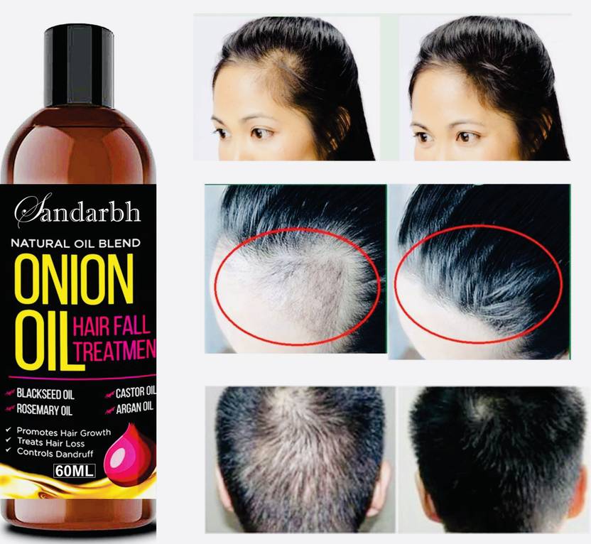 Sandarbh Onion Hair Oil with 14 Essential Oils for Hair Regrowth