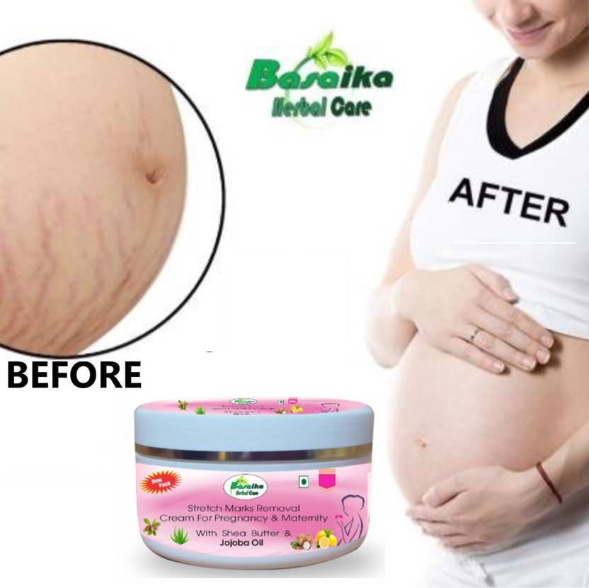 Basaika Herbal Care Stretch marks removal Cream Price in India, Buy