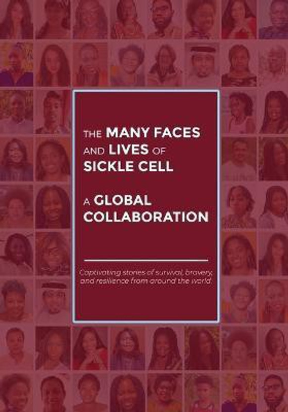 The The Many Faces and Lives of Sickle Cell - A Global Collaboration(English, Paperback, Nsofwa Agnes) - Flipkart Deal