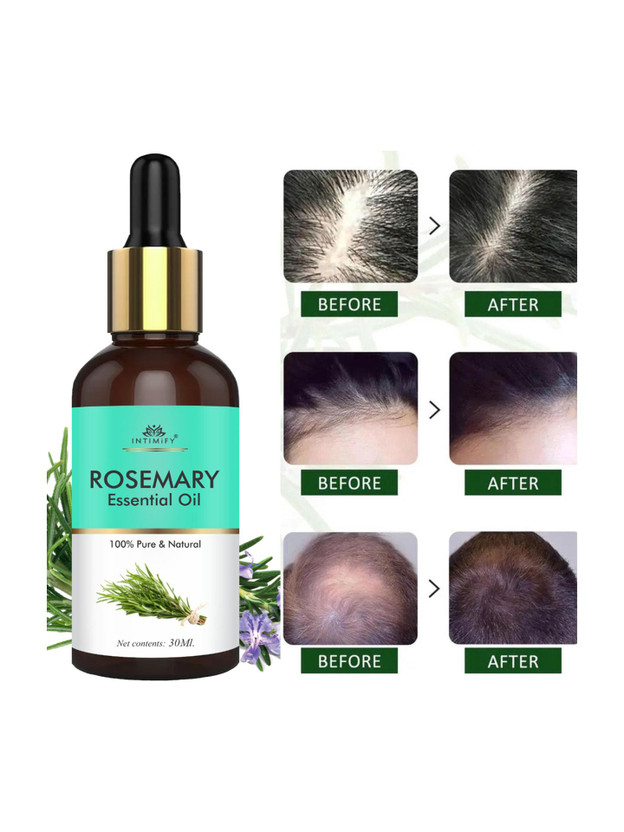 INTIMIFY 100% Pure & Natural Rosemary Essential Oil, Hair Growth, Skin Care, Aromatherapy(30 ml)