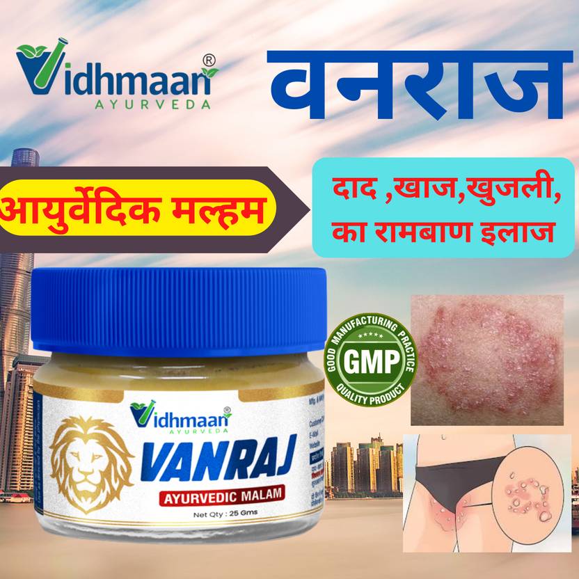 Vidhmaan Ayurvedic VanrajFungal infection Malam foritching,Ringworm