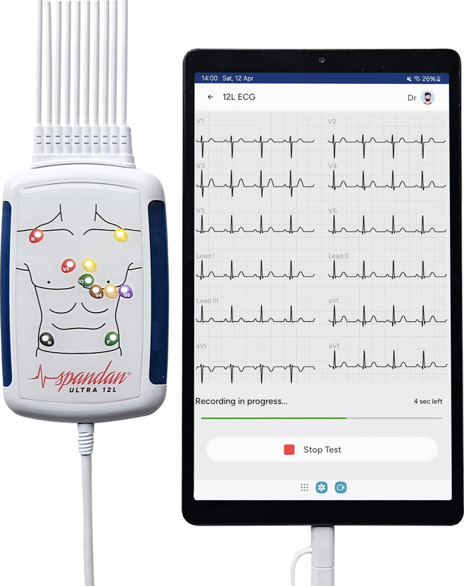 Sunfox Spadan Ultra Portable ECG Device Electrotherapy Device(Ultra)