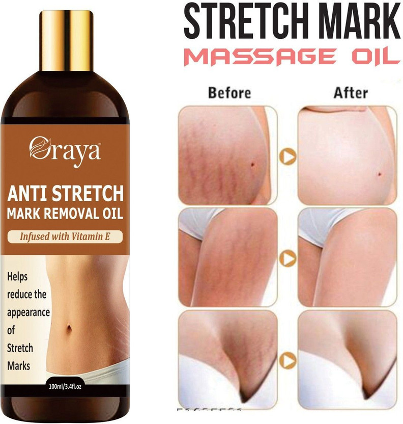 Oraya Stretch Oil for Stretch Marks Removal Post Pregnancy fast work-(100)