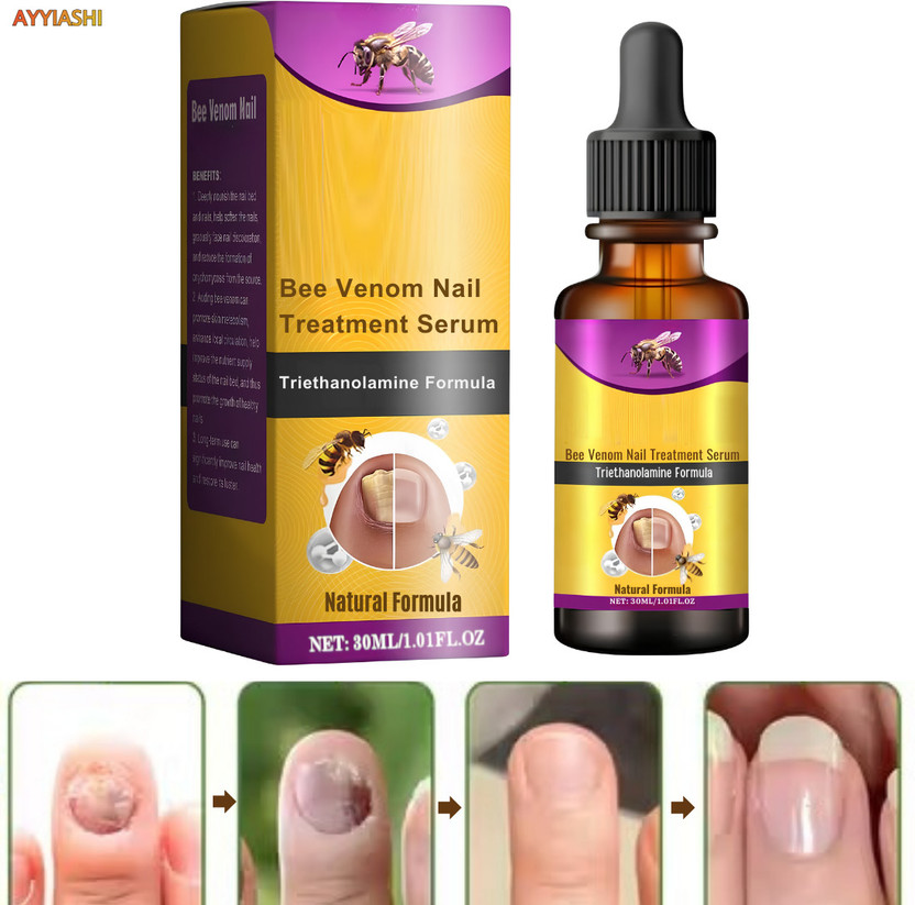 AYYIASHI Fungi Free Nail Treatment Serum For Healing Damaged Nails
