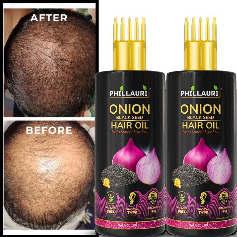Phillauri Onion Black Seed Hair Oil Men & Women Long Hair - Hair Regrowth beautifull Hair Oil(200 ml)