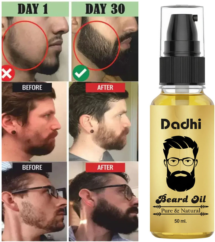 Dadhi Herbal Beard Growth Oil Gold for Smooth & Dense Beard – 50ml Hair Oil(50 ml)