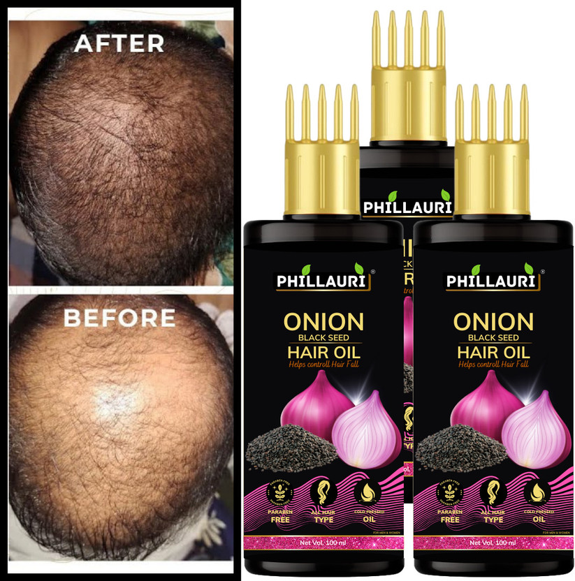 Phillauri Onion Black Seed Hair Oil Men & Women Long Hair - Hair Regrowth beautifull Hair Oil(300 ml)