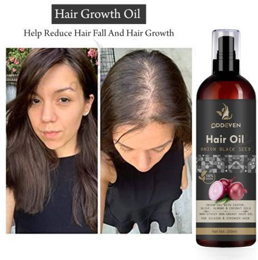 ODDEVEN Red Onion Hair Oil 200ml Controls Hair Fall No Mineral Oil