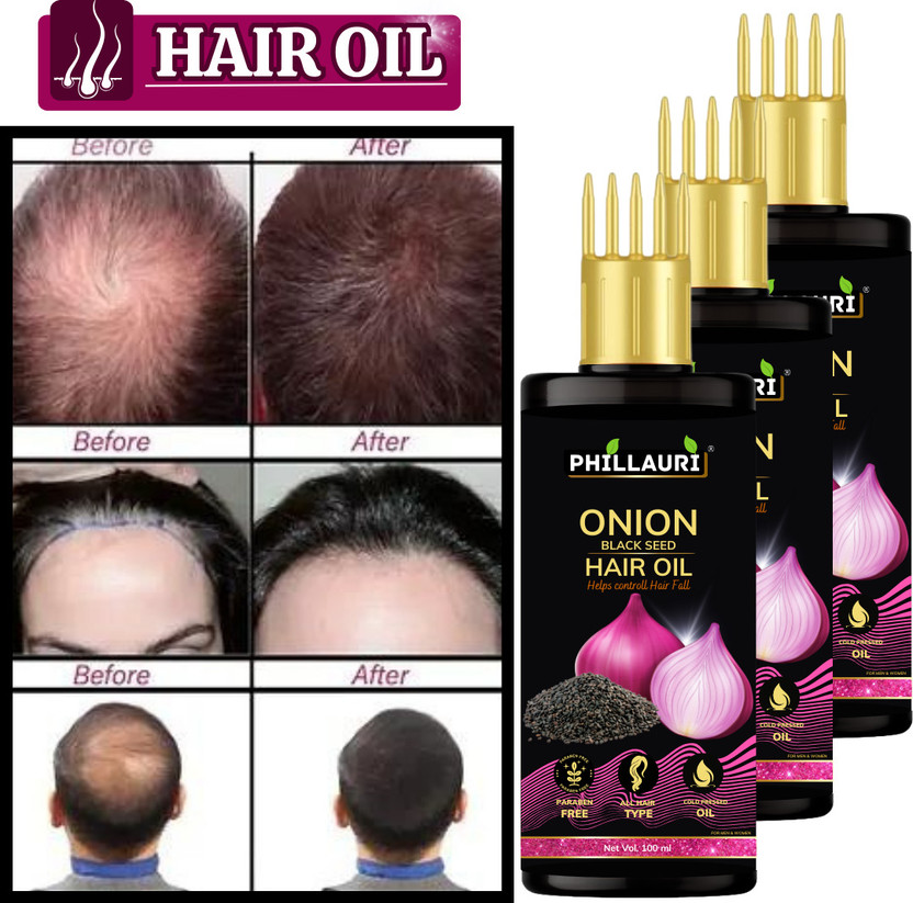 Phillauri Red Black Seed Onion Hair Loss Control Hair Oil For Neturaly And Strong Hair Oil(300 ml)