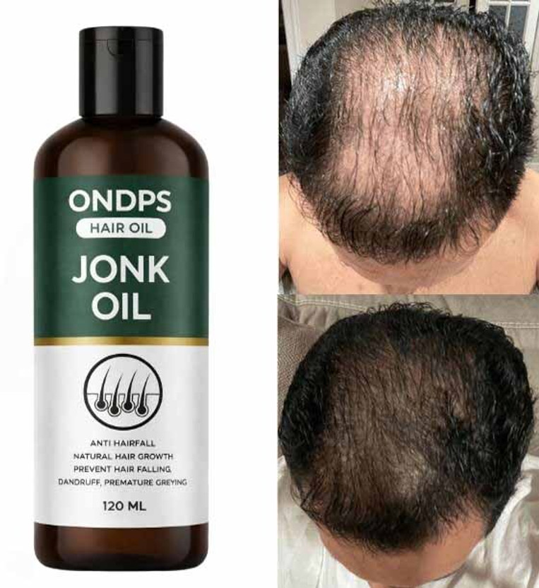 ONDPS ONDPS Jonk Oil for Hair Fall Control & Hair Regrowth A111 Hair Oil(120 ml) - Flipkart Deal