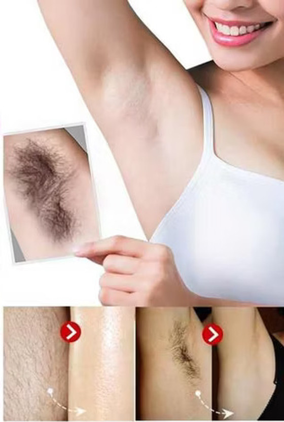 Wiffy Intimate/Private Hair Removal Cream for Men for Unwanted Coarse Pubic Hair Cream Spray(100 ml)