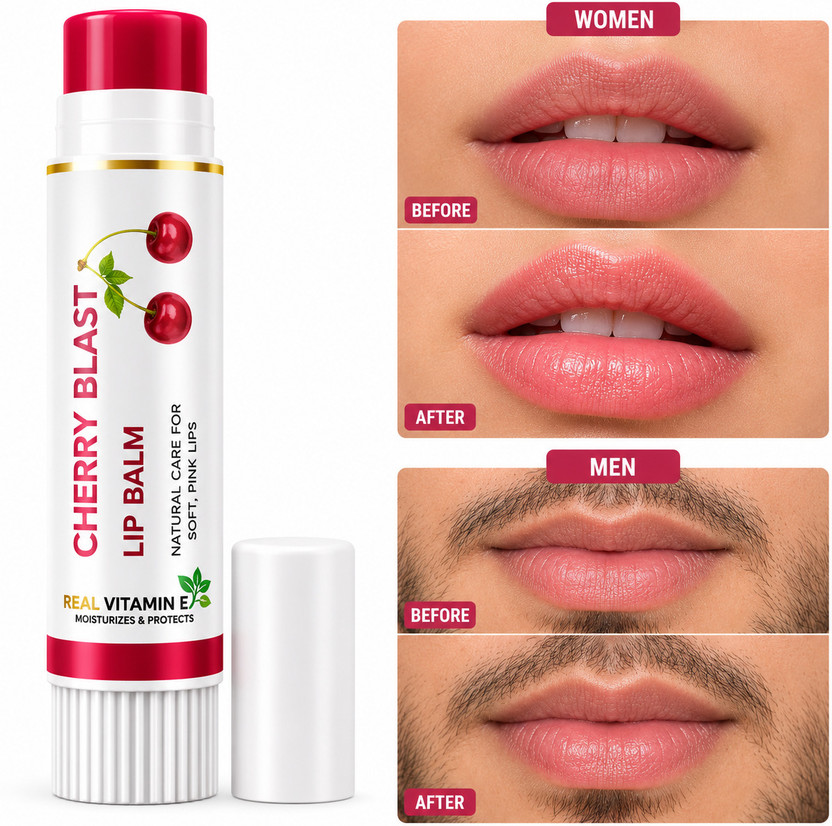 7days natural Tinted Lip Balm For with Shea Butter for Dry Dark Lips, Cherry Berry Gloss Lip Cherry(Pack of: 1, 15 g)