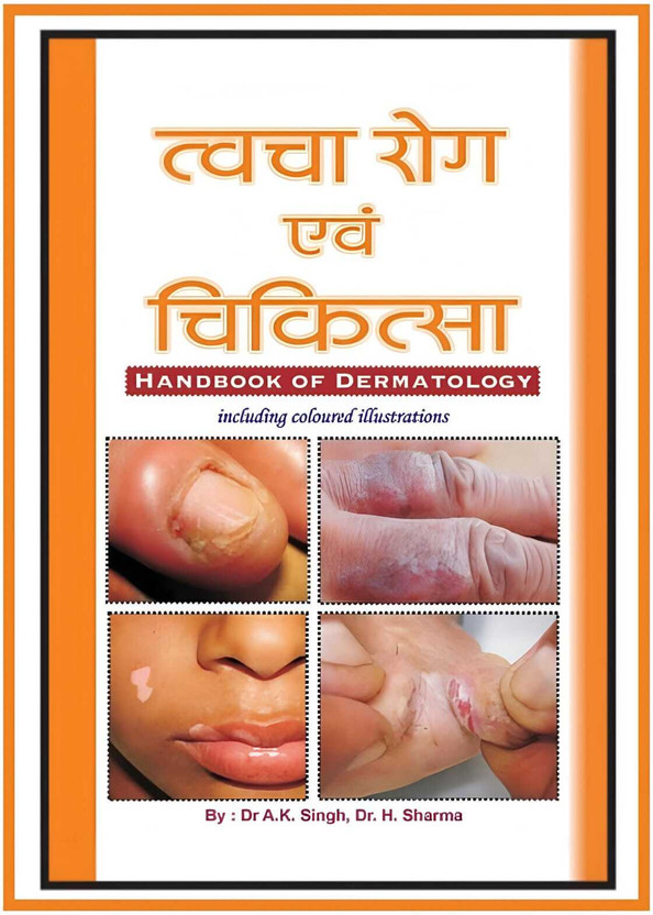 Twacha Twacha Rog & Chikitsa (HandBook Of Dermatology) In Hindi With COLOURED CLEAR PICTURES(Paperback, Hindi, Dr AK Singh, Dr H Sharma) - Flipkart Deal