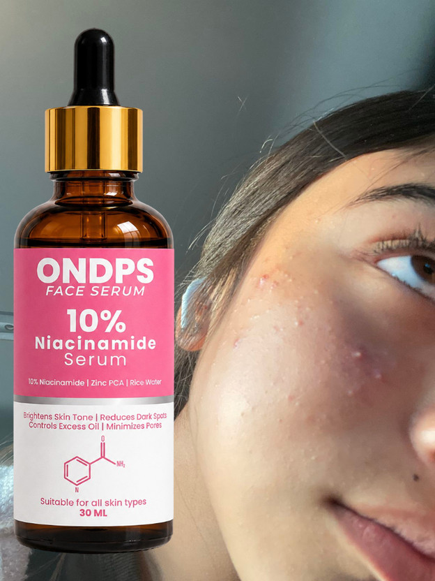 ONDPS ONDPS 10% Niacinamide Face Serum for Acne Marks, Blemishes & Oil Balancing with Zinc | Skin Clarifying Anti Acne Serum for Oily & Acne Prone Skin XXAA(30 ml) - Flipkart Deal