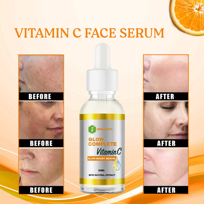 Forecast Vitamin C + Hyaluronic Acid Serum – Hydrating & Brightening Face Serum(30 ml)