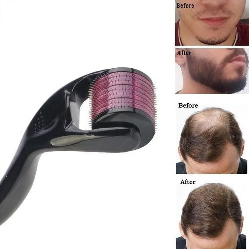 ESZAZX Derma Roller For Hair Growth 0.5 mm with 540 Titanium Needles(40 g)