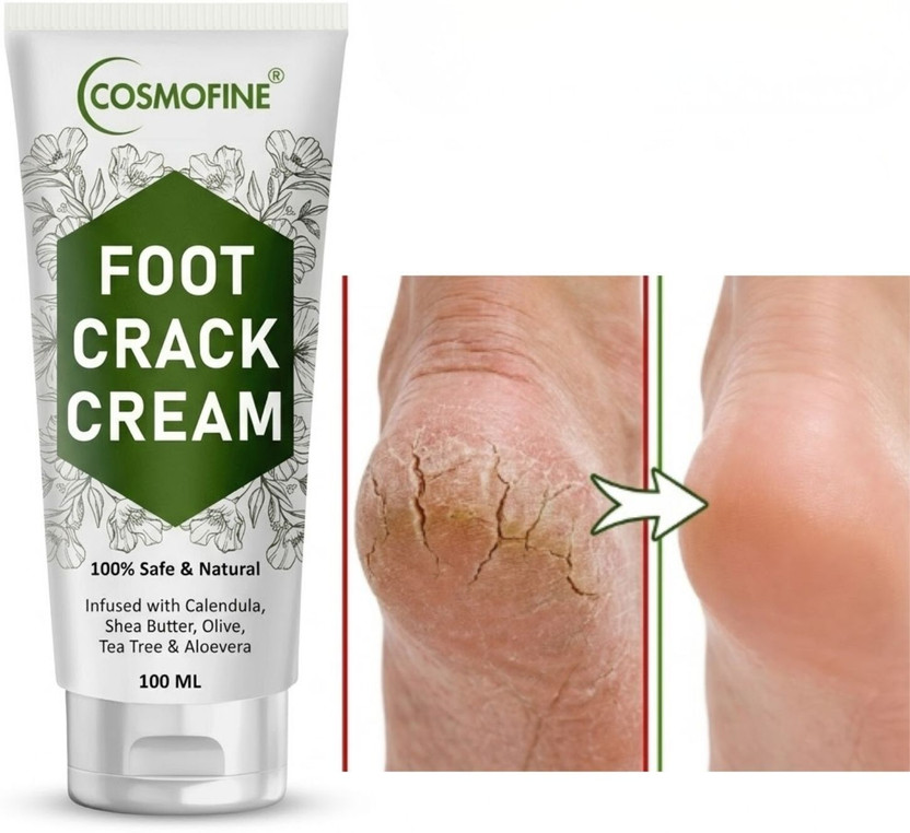 cosmofine cosmofine Buy Foot Care Cream | Cracked Heel & Dry Feet cream(100 ml) - Flipkart Deal