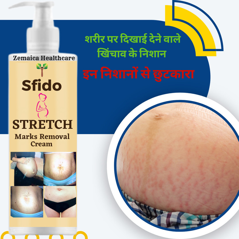 Zemaica Healthcare Stretch Marks Minimize , Stretch Marks & Even Out Skin Tone Men & Women(100 g)