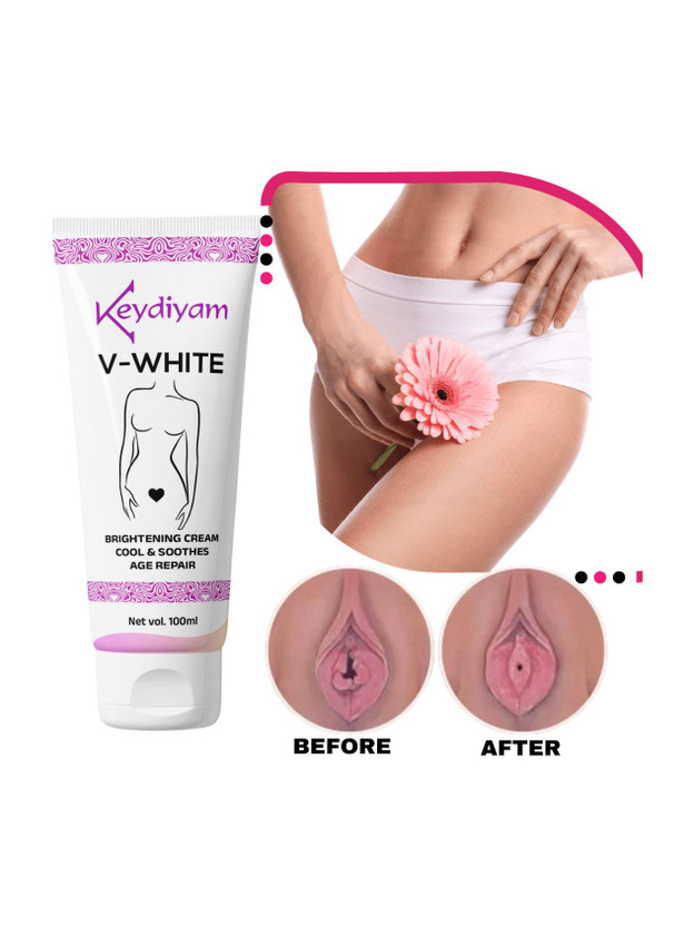 keydiyam V White Intimate Area Whitening Cream skin lightening private areas Intimate Cream(100 g)