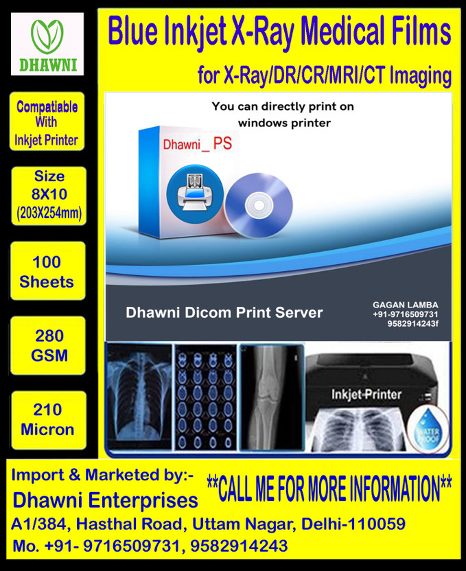 Dhwani Blue Inkjet Medical X Ray Film Size 8 X 10 210 Mic 100 Sheets Combo Pack X-Ray Viewer(For Printing Use X-RAY, CR & DR)