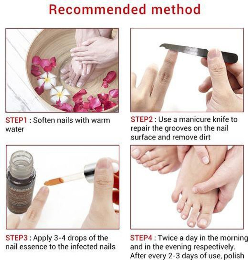 Discover 139+ antifungal ointment for nails super hot songngunhatanh