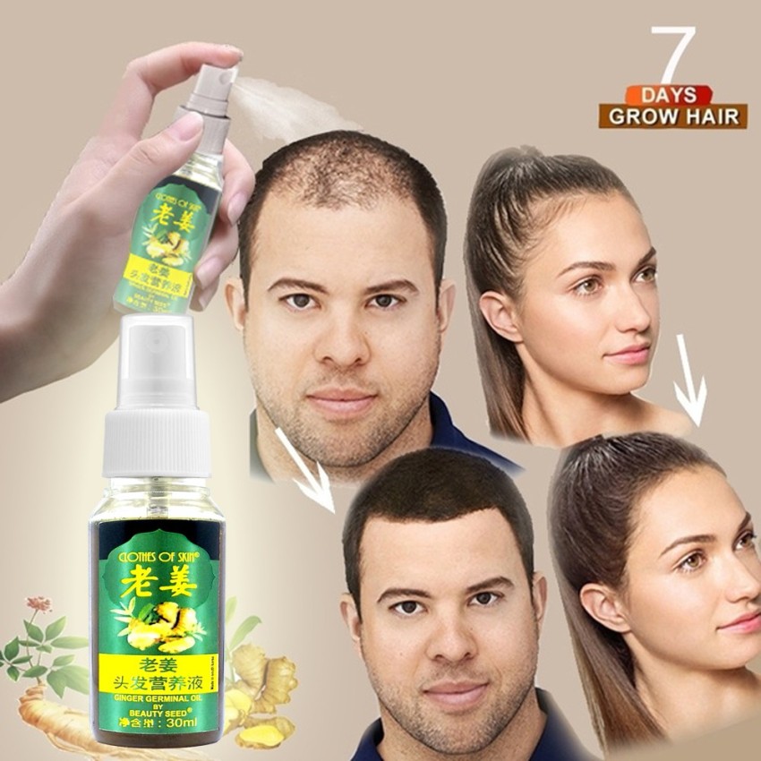 5 PACK Ginger Oil for Hair GrowthHair Growth India  Ubuy